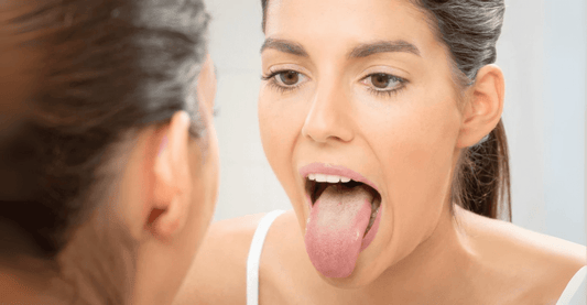 Lengua blanca: la señal silenciosa de que algo no anda bien por dentro